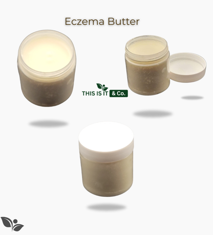 Eczema Butter  Local-Delivery ONLY Won't Ship!