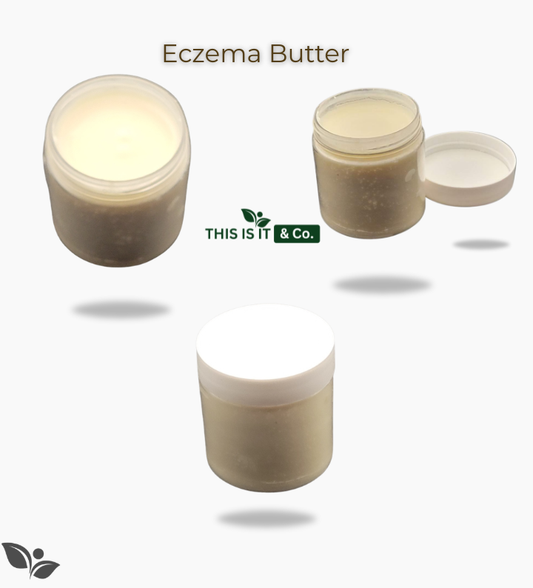 Eczema Butter  Local-Delivery ONLY Won't Ship!